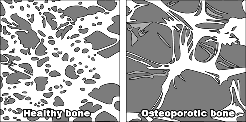 bone